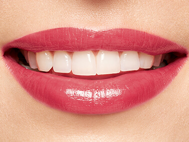 Joli Rouge auf den Lippen